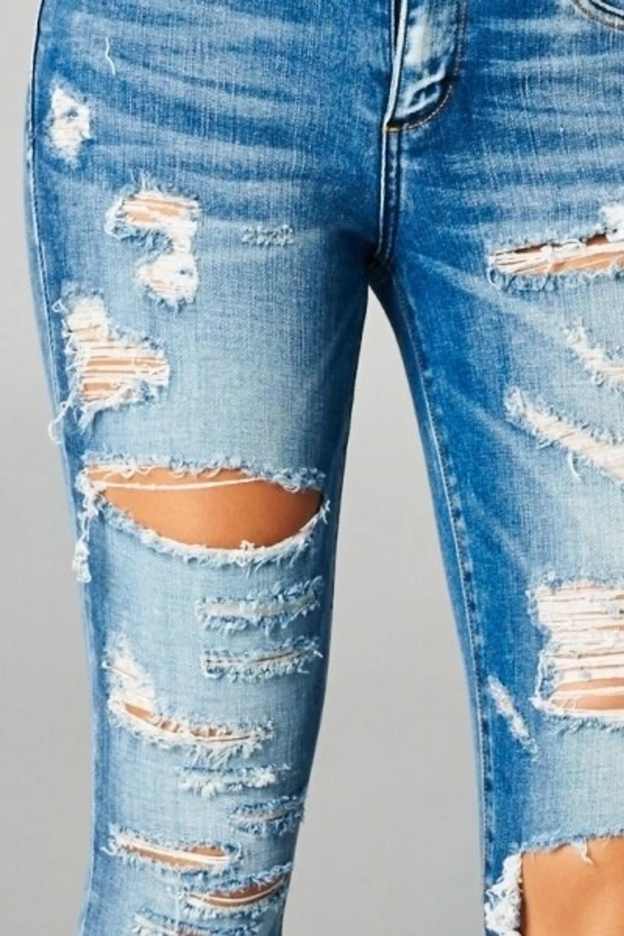 Distressed It Up Skinny Jeans